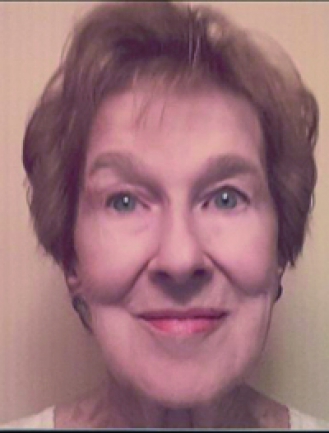 BEAUPRÉ DUBOIS JACQUELINE